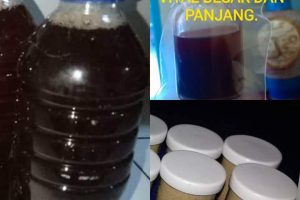Galeri Terapi ALat VItal Cisolok (13)