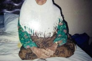 Galeri Terapi ALat VItal Cisolok (5)