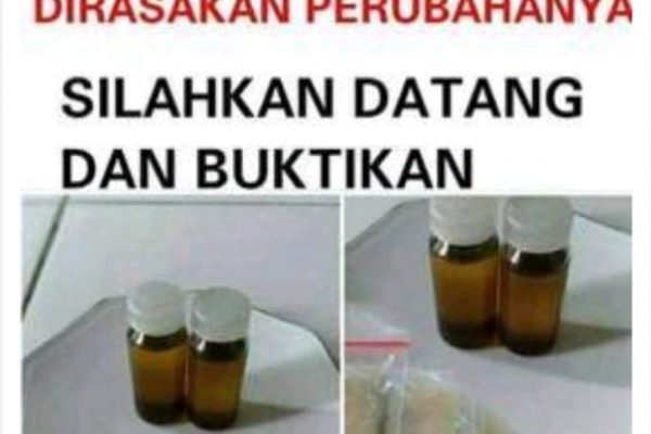 Galeri Terapi ALat VItal Cisolok (6)